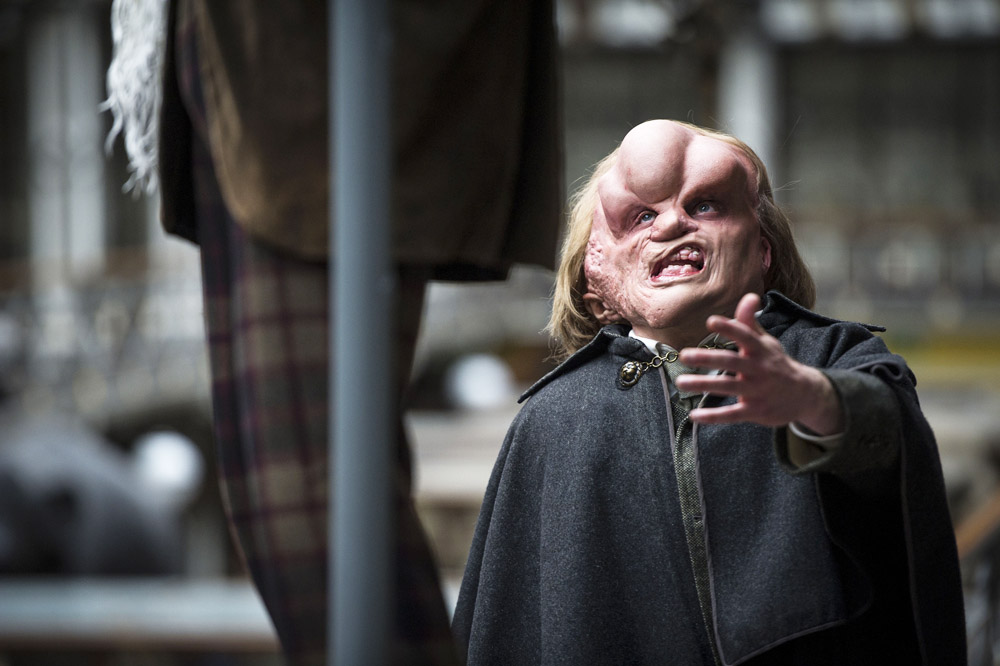 Joseph Drake as Joseph Merrick in BBC1's Ripper Street. Photo: Steffan Hill/BBC/Tiger Aspect